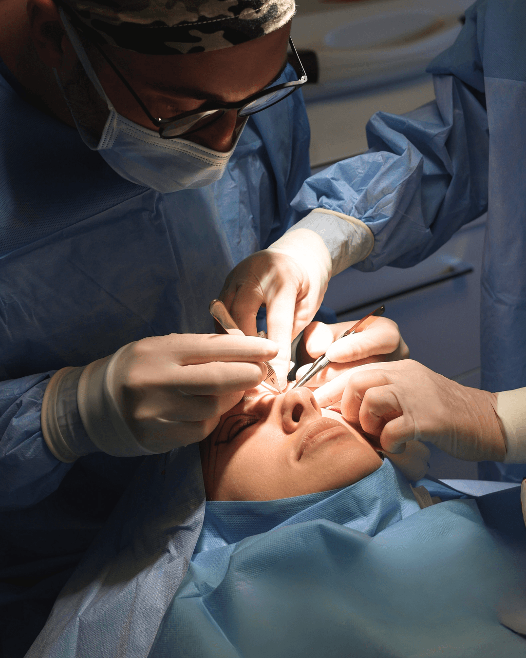 Lekarz w trakcie zabiegu blefaroplastyki - precyzyjna chirurgia powiek górnych w SkyClinic