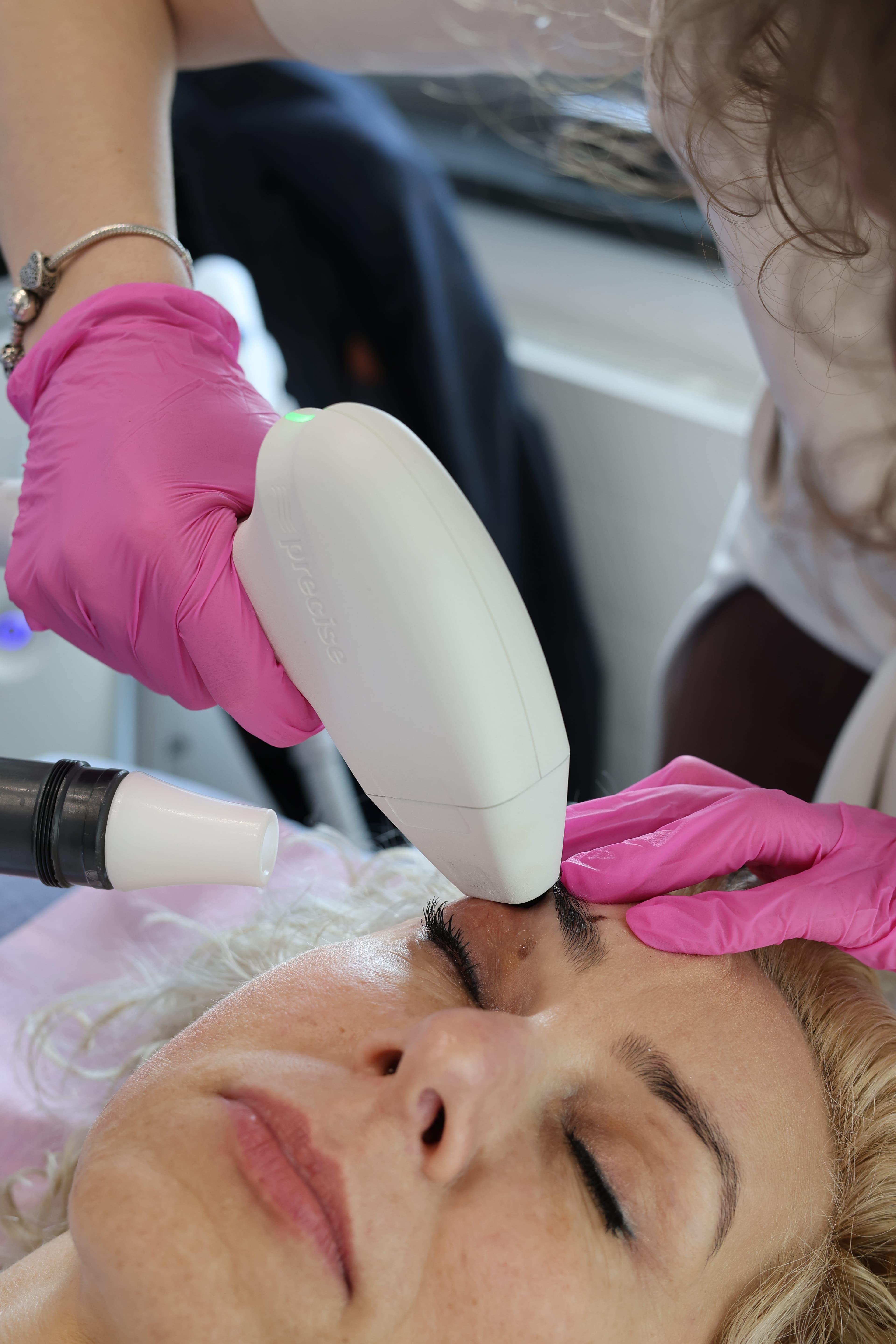 Zabieg SofWave - nieinwazyjny lifting ultradźwiękowy twarzy w klinice SkyClinic