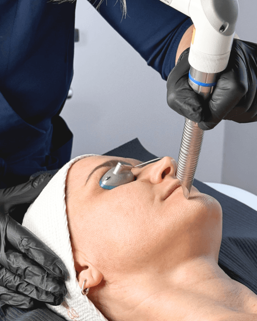 Laserowy lifting Fotona w klinice SkyClinic