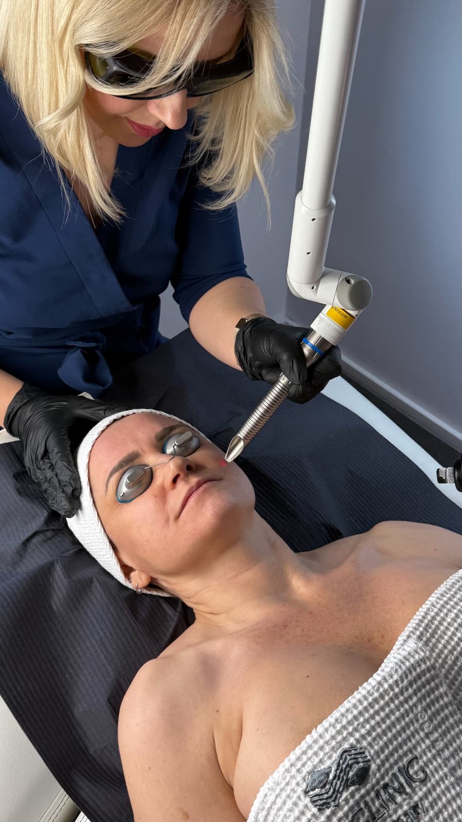Laserowy zabieg Fotona twarzy w SkyClinic