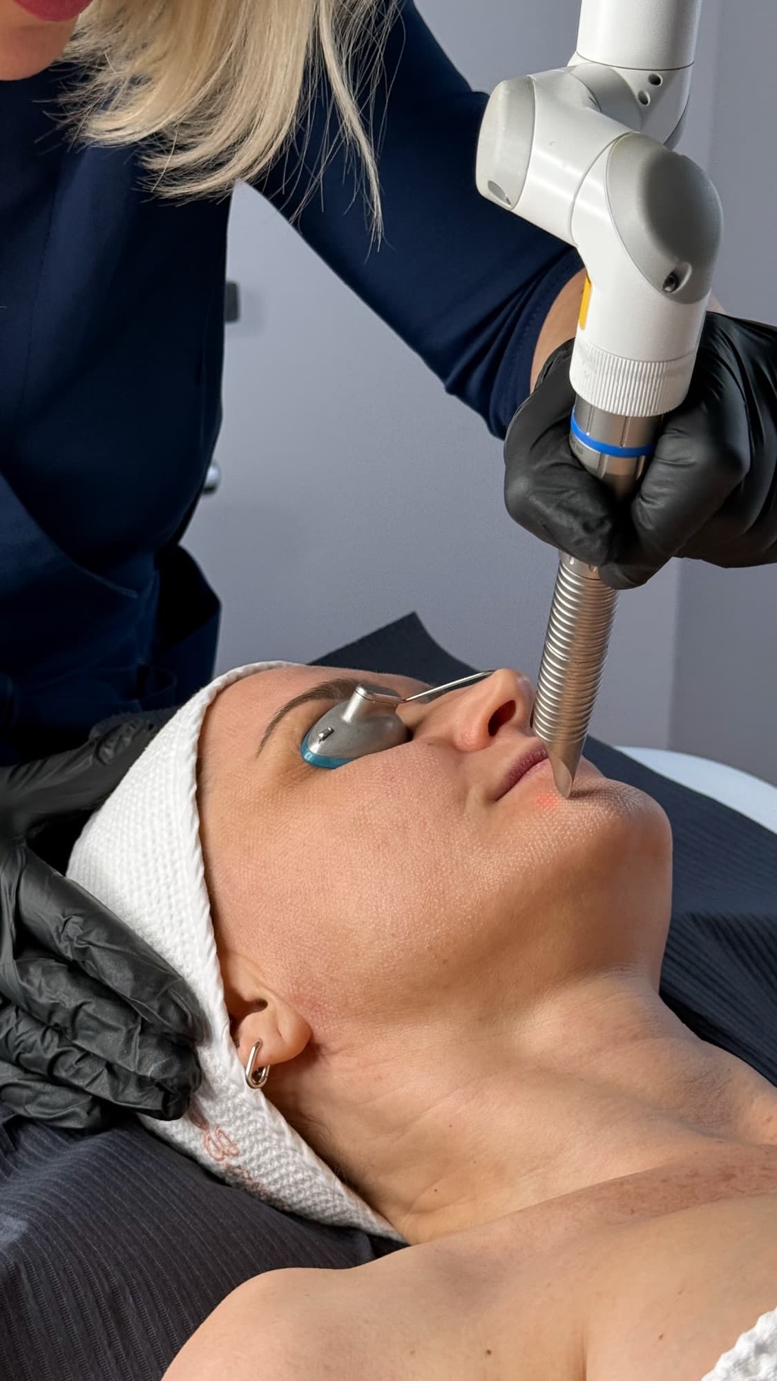 Specjalistka SkyClinic wykonująca laserowy zabieg Fotona na twarzy Pacjentki